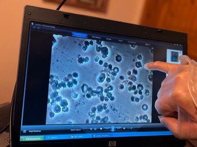 Kissinger Txostena, txertoak eta gehiegizko heriotzak