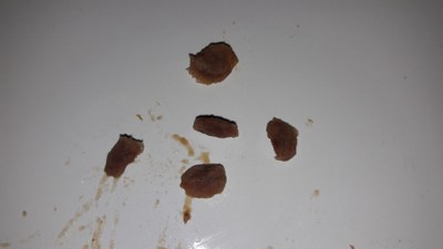 Mizpiraren hezurtxoak Mizpiraren hezurtxoak